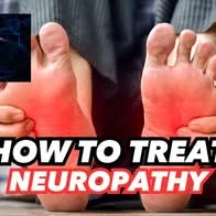 Peripheral Neuropathy Relief in the Feet & Legs- Physical Therapy Treatment
