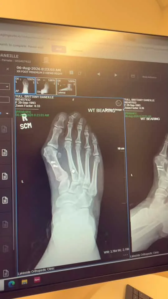 May be an image of xray and bone