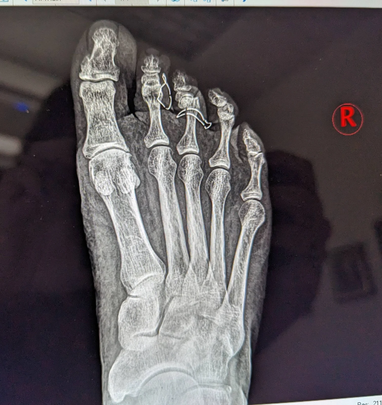 May be an image of bone and xray