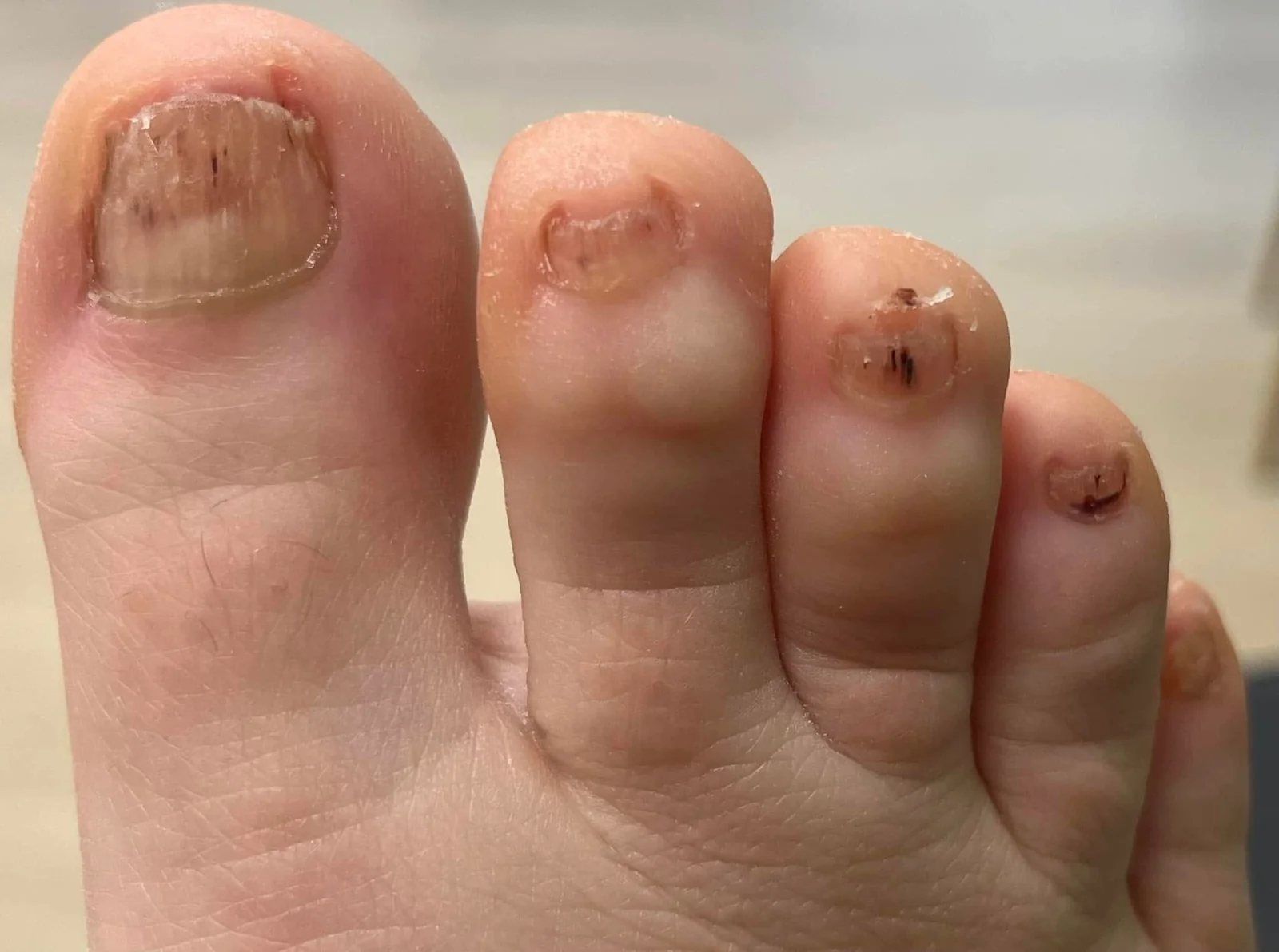 No photo description available.