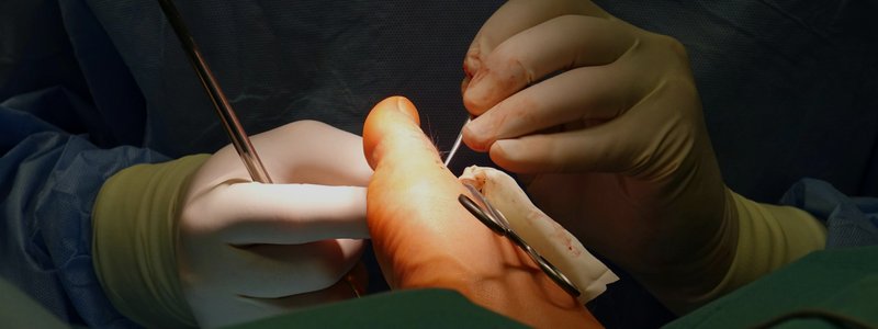 Surgery Complications & Wound Healing